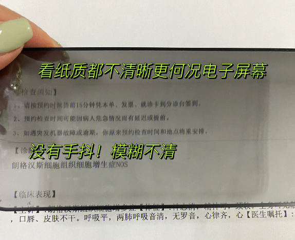 手机防窥膜引发热议：对眼睛有害 感觉快瞎了